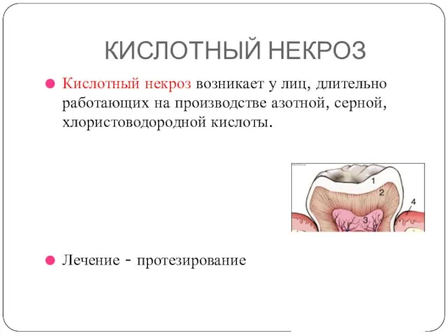 КИСЛОТНЫЙ НЕКРОЗ Кислотный некроз возникает у лиц, длительно работающих на производстве