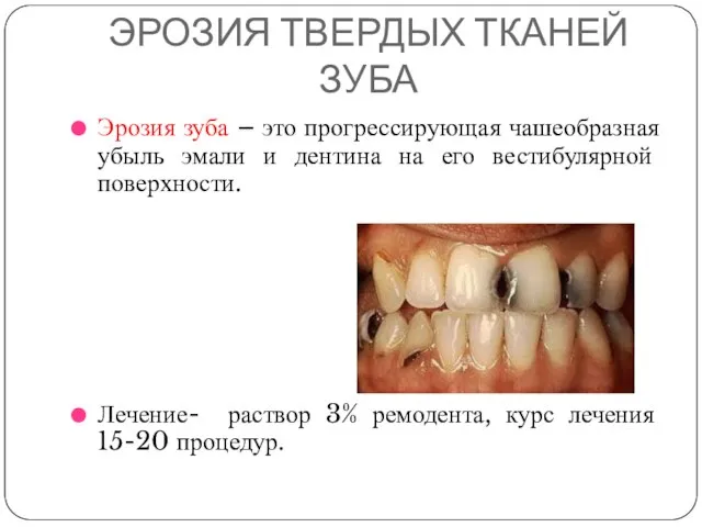 ЭРОЗИЯ ТВЕРДЫХ ТКАНЕЙ ЗУБА Эрозия зуба – это прогрессирующая чашеобразная убыль