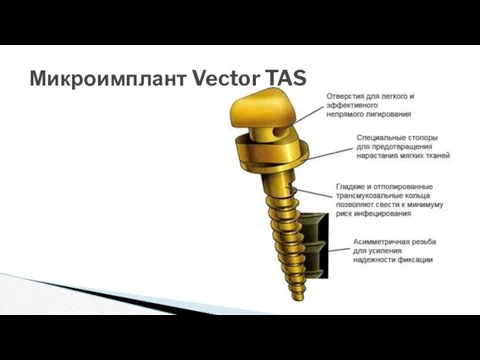 Микроимплант Vector TAS