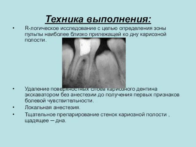 Техника выполнения: R-логическое исследование с целью определения зоны пульпы наиболее близко