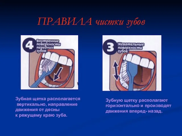 Зубная щетка располагается вертикально, направление движения от десны к режущему краю