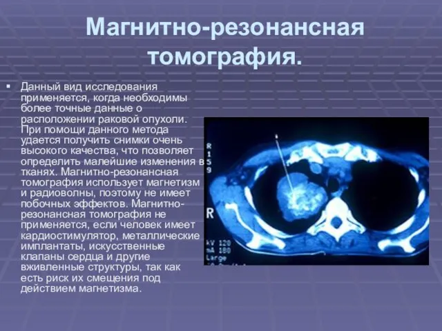 Магнитно-резонансная томография. Данный вид исследования применяется, когда необходимы более точные данные