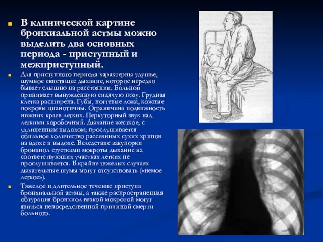 В клинической картине бронхиальной астмы можно выделить два основных периода -