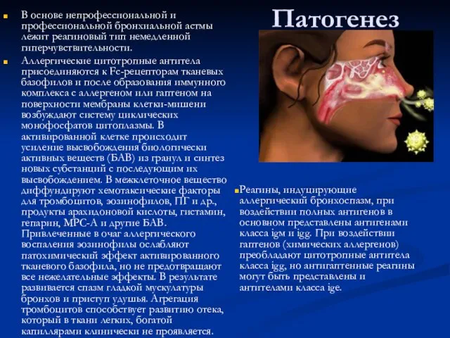 Патогенез В основе непрофессиональной и профессиональной бронхиальной астмы лежит реагиновый тип