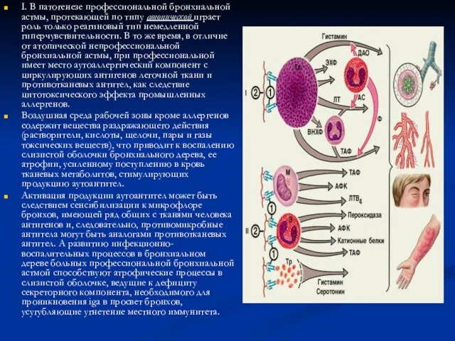 I. В патогенезе профессиональной бронхиальной астмы, протекающей по типу атопической играет