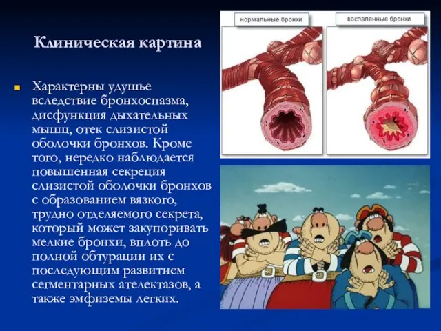 Клиническая картина Характерны удушье вследствие бронхоспазма, дисфункция дыхательных мышц, отек слизистой