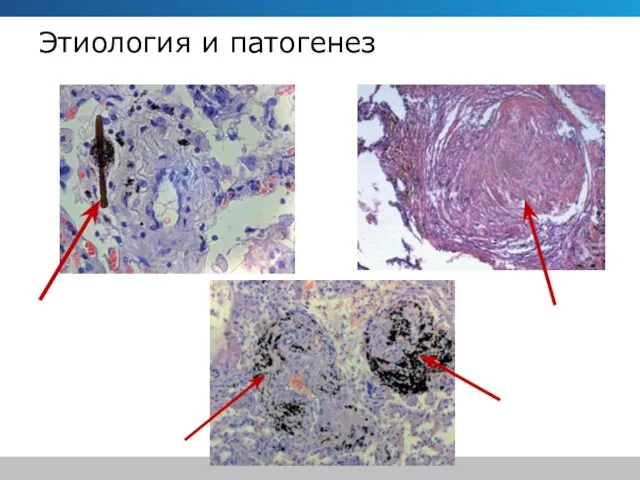 Этиология и патогенез