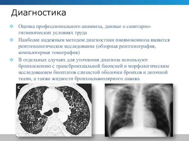 Диагностика Оценка профессионального анамнеза, данные о санитарно-гигиенических условиях труда Наиболее надежным