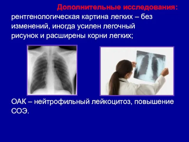 Дополнительные исследования: рентгенологическая картина легких – без изменений, иногда усилен легочный