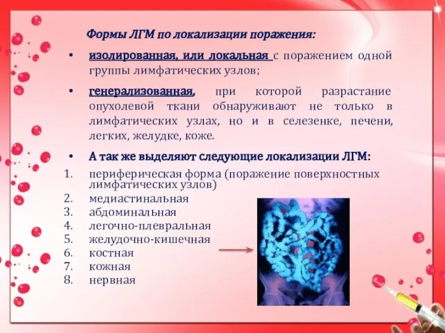 Формы ЛГМ по локализации поражения: изолированная, или локальная с поражением одной