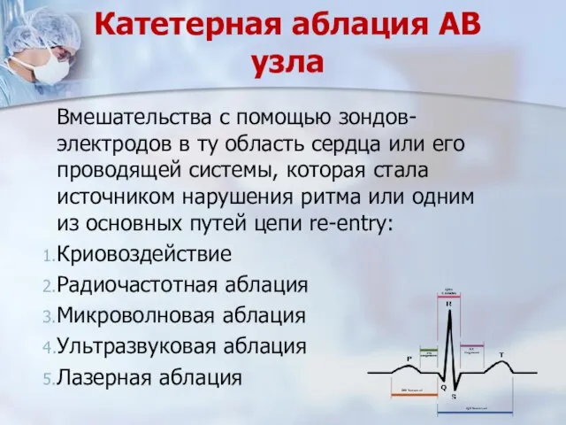 Катетерная аблация АВ узла Вмешательства с помощью зондов-электродов в ту область