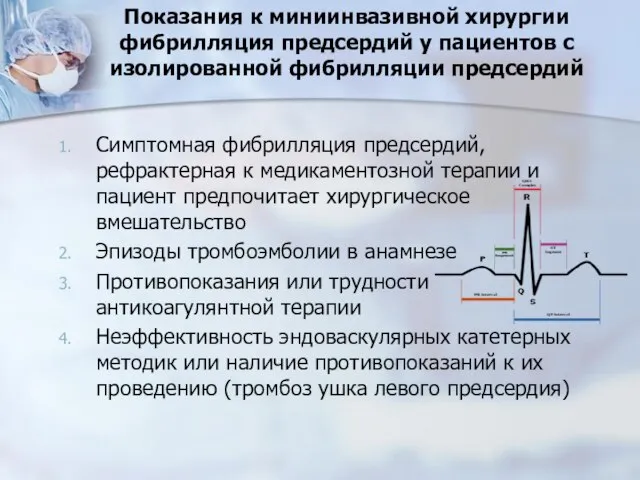 Показания к миниинвазивной хирургии фибрилляция предсердий у пациентов с изолированной фибрилляции