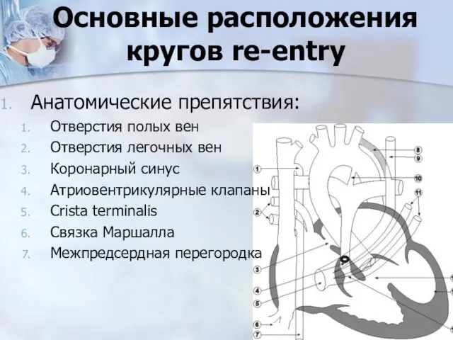 Основные расположения кругов re-entry Анатомические препятствия: Отверстия полых вен Отверстия легочных