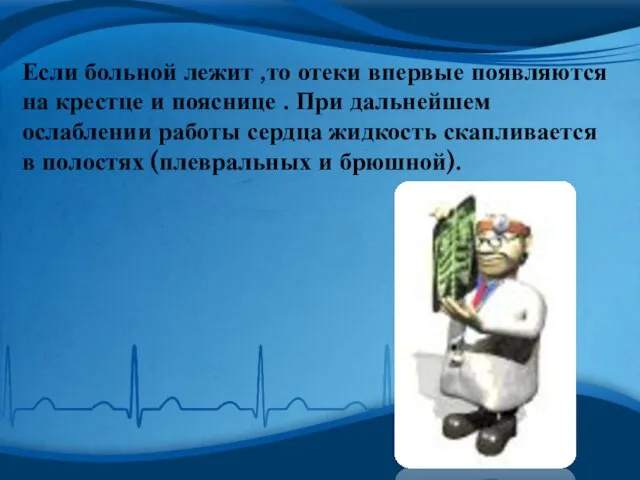 Если больной лежит ,то отеки впервые появляются на крестце и пояснице