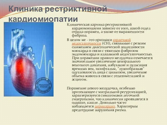 Клиника рестриктивной кардиомиопатии Клиническая картина рестриктивной кардиомиопатии зависит от того, какой