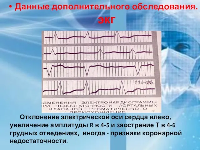 Данные дополнительного обследования. экг Отклонение электрической оси сердца влево, увеличение амплитуды