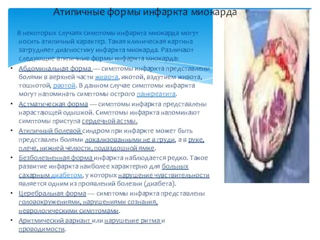 Атипичные формы инфаркта миокарда В некоторых случаях симптомы инфаркта миокарда могут