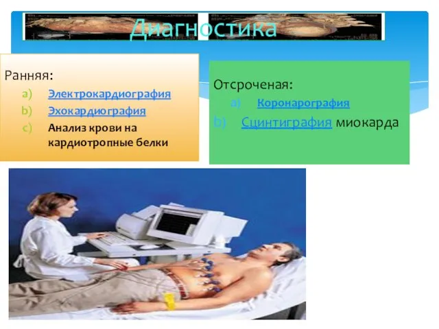 Ранняя: Электрокардиография Эхокардиография Анализ крови на кардиотропные белки Отсроченая: Коронарография Сцинтиграфия миокарда Диагностика