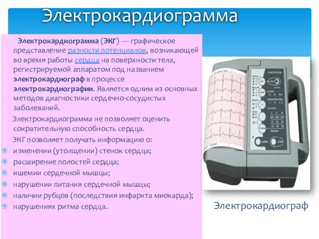 Электрокардиограмма Электрокардиограмма (ЭКГ) — графическое представление разности потенциалов, возникающей во время