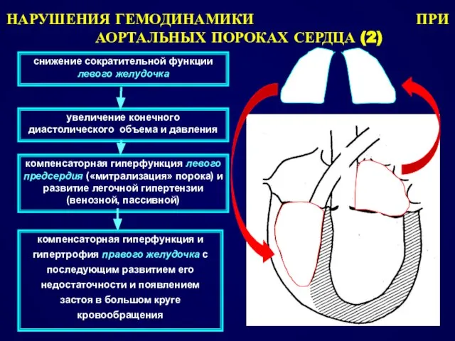 снижение сократительной функции левого желудочка НАРУШЕНИЯ ГЕМОДИНАМИКИ ПРИ АОРТАЛЬНЫХ ПОРОКАХ СЕРДЦА (2)