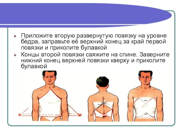 Приложите вторую развернутую повязку на уровне бедра, заправьте её верхний конец