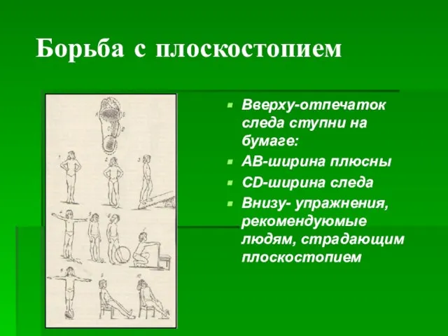 Борьба с плоскостопием Вверху-отпечаток следа ступни на бумаге: АВ-ширина плюсны CD-ширина