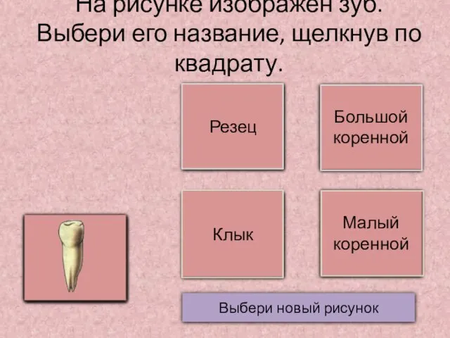 На рисунке изображен зуб. Выбери его название, щелкнув по квадрату. Выбери