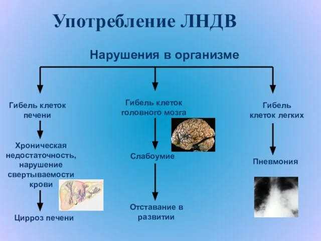 Употребление ЛНДВ Гибель клеток печени Хроническая недостаточность, нарушение свертываемости крови Цирроз