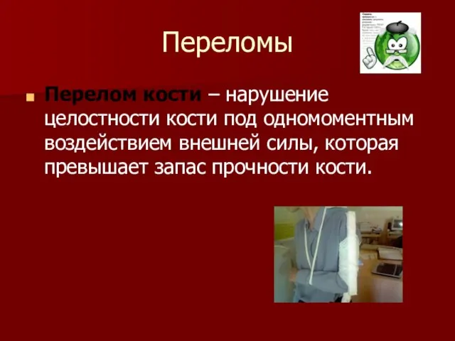 Переломы Перелом кости – нарушение целостности кости под одномоментным воздействием внешней