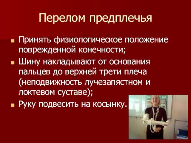 Перелом предплечья Принять физиологическое положение поврежденной конечности; Шину накладывают от основания