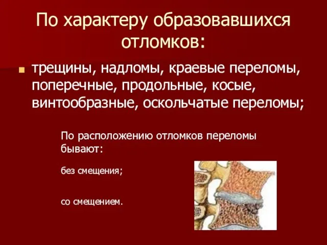 По характеру образовавшихся отломков: трещины, надломы, краевые переломы, поперечные, продольные, косые,