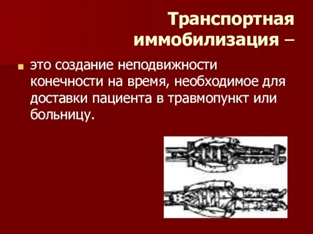 Транспортная иммобилизация – это создание неподвижности конечности на время, необходимое для