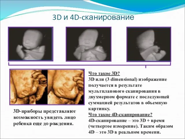 3D и 4D-cканирование Что такое 3D? 3D или (3 dimensional) изображение