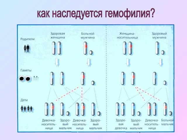 как наследуется гемофилия?