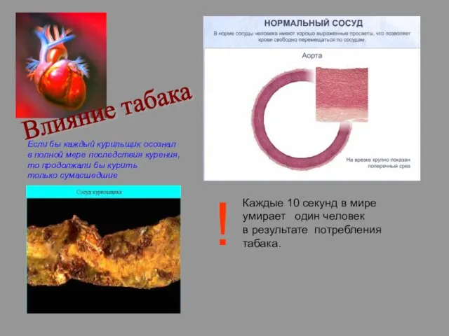 Влияние табака Если бы каждый курильщик осознал в полной мере последствия