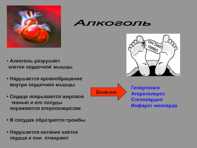 Алкоголь Алкоголь разрушает клетки сердечной мышцы Нарушается кровообращение внутри сердечной мышцы