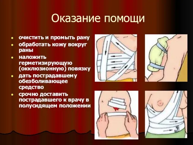 Оказание помощи очистить и промыть рану обработать кожу вокруг раны наложить