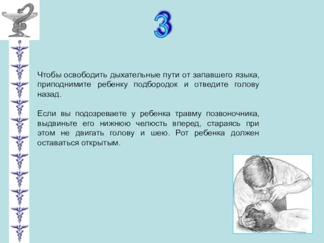 3 Чтобы освободить дыхательные пути от запавшего языка, приподнимите ребенку подбородок