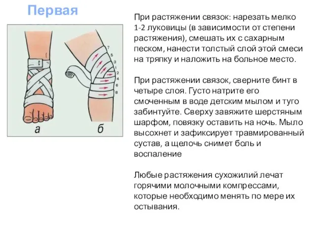 При растяжении связок: нарезать мелко 1-2 луковицы (в зависимости от степени