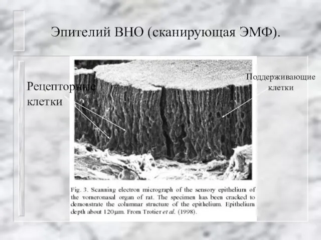 Эпителий ВНО (сканирующая ЭМФ). Рецепторные клетки Поддерживающие клетки