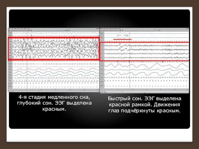 4-я стадия медленного сна, глубокий сон. ЭЭГ выделена красным. Быстрый сон.