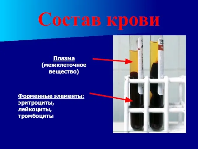 Состав крови Плазма (межклеточное вещество) Форменные элементы: эритроциты, лейкоциты, тромбоциты