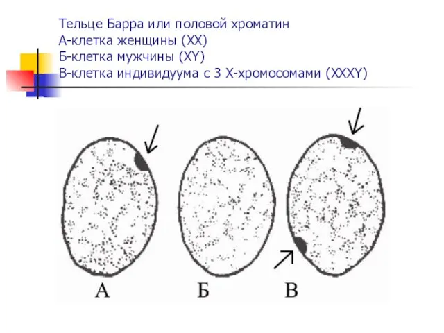 Тельце Барра или половой хроматин А-клетка женщины (ХХ) Б-клетка мужчины (ХY)