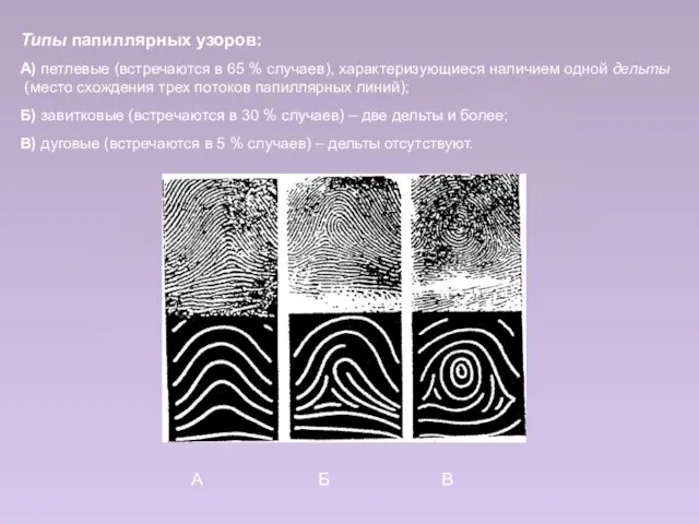 Типы папиллярных узоров: А) петлевые (встречаются в 65 % случаев), характеризующиеся