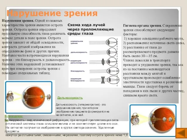 Нарушение зрения Близорукость Близорукость - вид клинической рефракции, при которой преломляющая