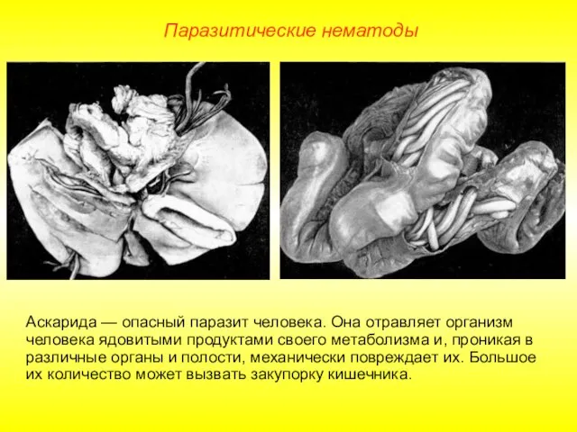 Аскарида — опасный паразит человека. Она отравляет организм человека ядовитыми продуктами