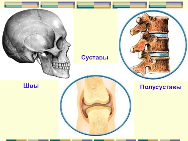 Швы Полусуставы Суставы