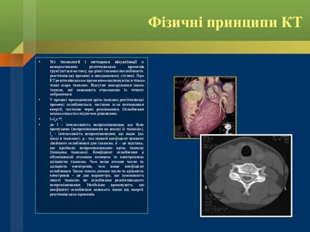 Фізичні принципи КТ Усі технології і методики візуалізації з використанням рентгенівських