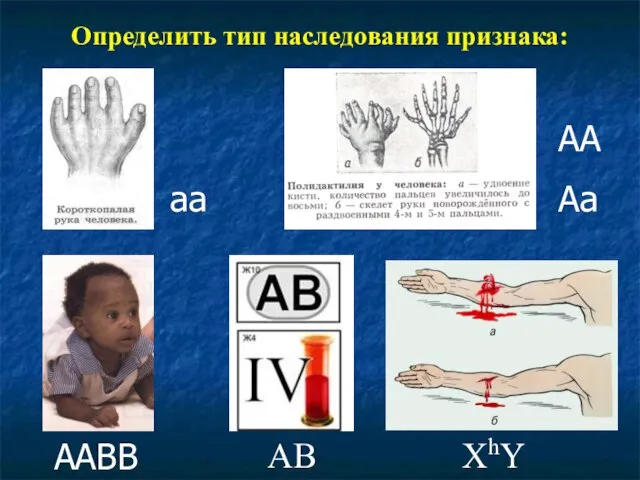 Определить тип наследования признака: аа АА Аа ААВВ АВ ХhY