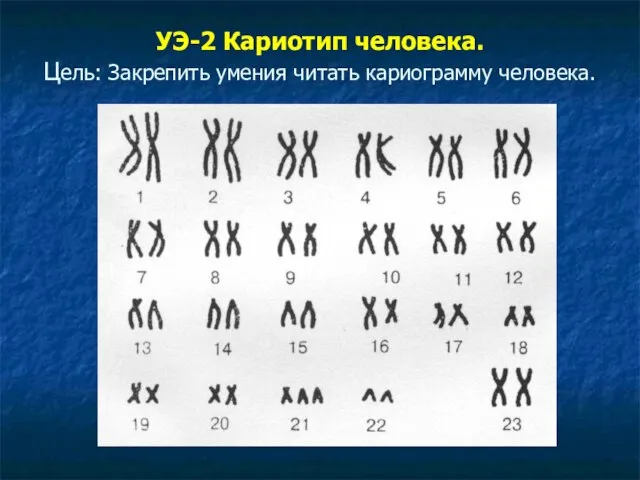 УЭ-2 Кариотип человека. Цель: Закрепить умения читать кариограмму человека.